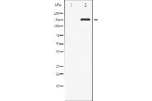 Western blot analysis of c-Met phosphorylation expression in HepG2 whole cell lysates,The lane on the left is treated with the antigen-specific peptide. (c-MET anticorps  (pTyr1003))