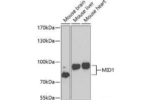 Western blot analysis of extracts of various cell lines using MID1 Polyclonal Antibody at dilution of 1:1000. (MID1 anticorps)