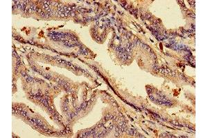 Immunohistochemistry of paraffin-embedded human prostate tissue using ABIN7158740 at dilution of 1:100 (ACP6 anticorps  (AA 35-324))