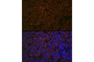 Immunofluorescence analysis of mouse placenta cells using CYP26 Rabbit mAb (ABIN7266654) at dilution of 1:100 (40x lens). (CYP26A1 anticorps)