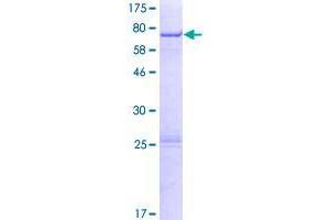 Image no. 1 for Zinc Finger, CCHC Domain Containing 12 (ZCCHC12) (AA 1-402) protein (GST tag) (ABIN1325658)