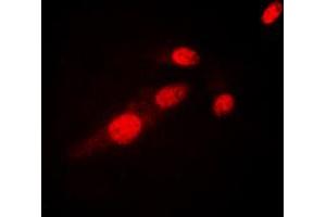 Immunofluorescent analysis of NF-kappaB p65 (AcK310) staining in HeLa cells.