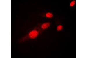 Immunofluorescent analysis of NF-kappaB p65 (AcK310) staining in HeLa cells. (NF-kB p65 anticorps  (acLys310))