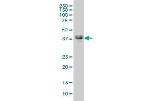MEF2BNB monoclonal antibody (M09), clone 3D8 Western Blot analysis of MEF2BNB expression in MCF-7 ( Cat # L046V1 ).