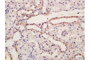 Formalin-fixed and paraffin embedded rat kidney tissue labeled with Rabbit Anti-NALP6 Polyclonal Antibody, Unconjugated (ABIN2559652) at 1:200 followed by conjugation to the secondary antibody and DAB staining