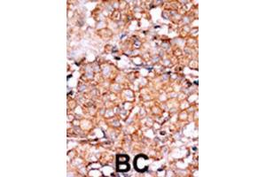 Immunohistochemistry (IHC) image for anti-RAD9 Homolog A (S. Pombe) (RAD9A) (pSer328) antibody (ABIN3001777) (RAD9A anticorps  (pSer328))