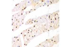 Immunohistochemistry of paraffin-embedded mouse heart using Nono Antibody (ABIN5973035) at dilution of 1/100 (40x lens). (NONO anticorps)