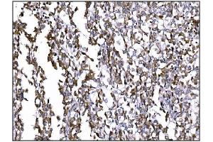 IHC analysis of Prolyl Endopeptidase/PREP using anti-Prolyl Endopeptidase/PREP antibody (ABIN7599118).