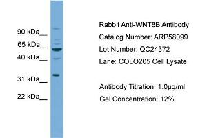 WB Suggested Anti-WNT8B  Antibody Titration: 0. (WNT8B anticorps  (N-Term))