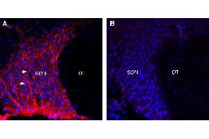 Expression of Neuropeptide S Receptor in rat supraoptic nucleus (SON). (NPSR1 anticorps  (Extracellular))