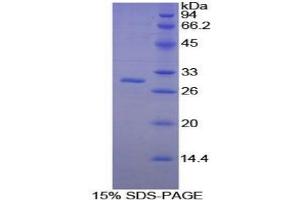 SDS-PAGE analysis of Mouse PAFAH1B3 Protein.