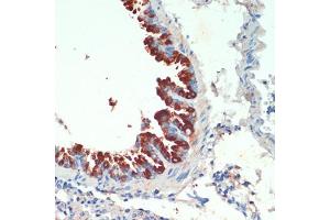 Immunohistochemistry of paraffin-embedded mouse lung using KIF5B antibody (ABIN7268136) at dilution of 1:200 (40x lens).