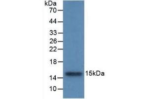 Detection of Recombinant CSTB, Rat using Monoclonal Antibody to Cystatin B (CSTB) (CSTB anticorps  (AA 2-98))