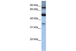 WB Suggested Anti-INPP5B Antibody Titration: 0. (INPP5B anticorps  (Middle Region))