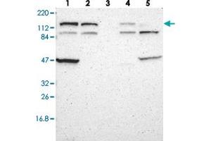 Western blot analysis of Lane 1: RT-4, Lane 2: U-251 MG, Lane 3: Human Plasma, Lane 4: Liver, Lane 5: Tonsil with DIAPH2 polyclonal antibody  at 1:250-1:500 dilution.
