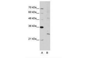 Image no. 3 for anti-Exosome Component 4 (EXOSC4) (N-Term) antibody (ABIN202117) (EXOSC4 anticorps  (N-Term))