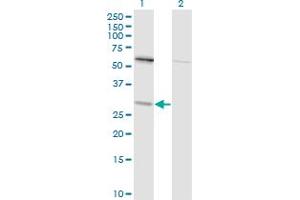 Western Blot analysis of TPMT expression in transfected 293T cell line by TPMT monoclonal antibody (M01), clone 1B5.