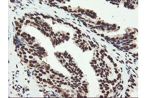 Image no. 11 for anti-Non-POU Domain Containing, Octamer-Binding (NONO) (AA 184-385) antibody (ABIN1491073) (NONO anticorps  (AA 184-385))