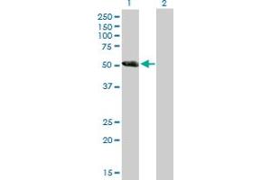 Western Blot analysis of DKFZP779L1558 expression in transfected 293T cell line by DKFZP779L1558 MaxPab polyclonal antibody. (CCDC91 anticorps  (AA 1-411))