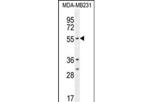 CYP2A7 Antibody (Center) (ABIN654434 and ABIN2844170) western blot analysis in MDA-M cell line lysates (35 μg/lane). (CYP2A7 anticorps  (AA 121-148))