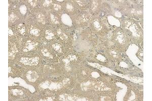 ABIN6255139 and ABIN6268986 at 1/100 staining human normal kidney tissue by IHC-P.