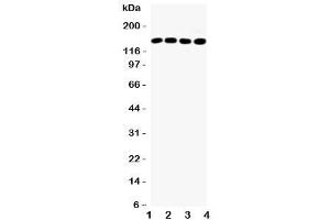 Western blot testing of IRS-1 antibody and Lane 1:  HeLa (IRS1 anticorps  (N-Term))