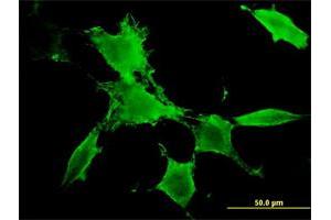 Immunofluorescence of monoclonal antibody to PAK3 on NIH/3T3 cell.