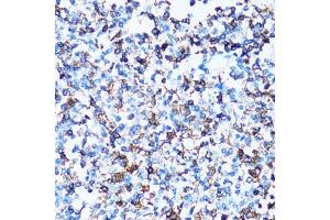 Immunohistochemistry of paraffin-embedded human tonsil using SPN antibody.