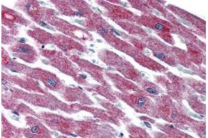 Heart, Human: Formalin-Fixed, Paraffin-Embedded (FFPE)