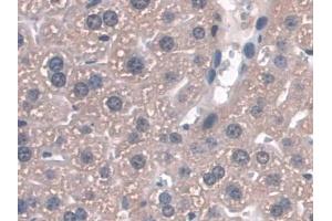 Detection of GPX3 in Mouse Liver Tissue using Polyclonal Antibody to Glutathione Peroxidase 3, Plasma (GPX3)