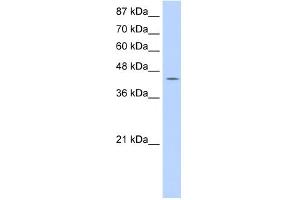 WB Suggested Anti-GTPBP9 Antibody Titration:  0. (OLA1 anticorps  (C-Term))
