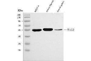 Western blot analysis of RAG2 using anti-RAG2 antibody (ABIN7601803).