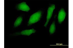Immunofluorescence of purified MaxPab antibody to RNF34 on HeLa cell.