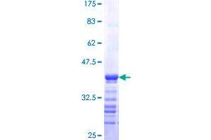 Image no. 1 for Rhotekin (RTKN) (AA 451-549) protein (GST tag) (ABIN1318954)