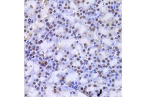 Immunohistochemistry of paraffin-embedded rat pancreas using CSNK1E Antibody. (CK1 epsilon anticorps)