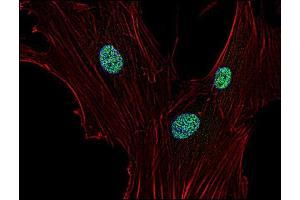 Immunofluorescence staining of p21 in human primary fibroblasts using anti-p21 (; green). (p21 anticorps)