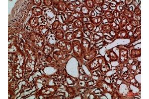 Immunohistochemical analysis of paraffin-embedded Human-kidney, antibody was diluted at 1:100 (EYA1 anticorps)