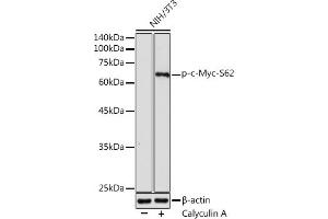Western blot analysis of extracts of NIH/3T3 cells, using Phospho-c-Myc-S62 antibody (ABIN3019544, ABIN3019545, ABIN3019546 and ABIN6225456) at 1:1000 dilution. (c-MYC anticorps  (pSer62))