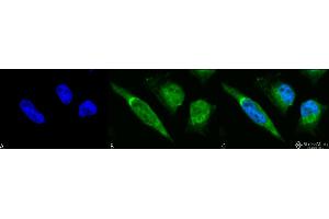 Immunocytochemistry/Immunofluorescence analysis using Rabbit Anti-GRP78 Polyclonal Antibody . (GRP78 anticorps  (Biotin))