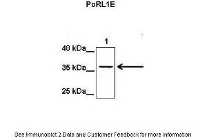 Lanes:  Lane1: 50 ug mouse heptoma cell lysate Primary Antibody Dilution:  1:1000 Secondary Antibody:  Anti-rabbit HRP Secondary Antibody Dilution:  1:5000 Gene Name:  PORL1E Submitted by:  Eekjoong Park, UCSD