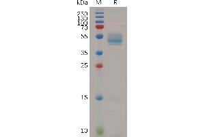 Human HBEGF Protein, hFc Tag on SDS-PAGE under reducing condition.