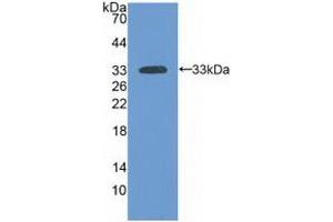 Western blot analysis of recombinant Human LAMa3. (LAMA3 anticorps  (AA 47-296))