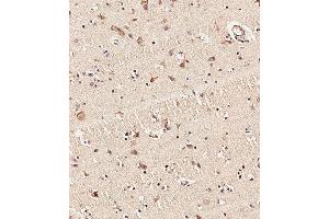 Immunohistochemical analysis of paraffin-embedded Human brain tissue using (ABIN6243263 and ABIN6578971) performed on the Leica® BOND RXm.