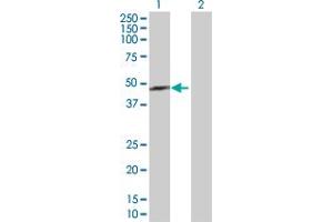 Western Blot analysis of TXNDC4 expression in transfected 293T cell line by TXNDC4 MaxPab polyclonal antibody. (ERP44 anticorps  (AA 1-406))