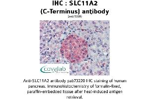 Image no. 1 for anti-Solute Carrier Family 11 (Proton-Coupled Divalent Metal Ion Transporters), Member 2 (SLC11A2) (C-Term) antibody (ABIN1739322)
