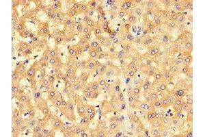 Immunohistochemistry of paraffin-embedded human liver tissue using ABIN7168546 at dilution of 1:100 (BHMT2 anticorps  (AA 1-200))