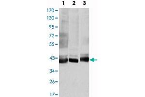 Western blot analysis using MAP2K4 monoclonal antibody, clone 5H4  against HepG2 (1), K-562 (2), and HEK293 (3) cell lysate. (MAP2K4 anticorps)