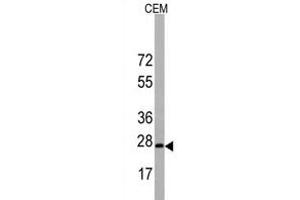 Western blot analysis of BarX1 Antibody (C-term) in CEM cell line lysates (35 μg/lane). (BARX1 anticorps  (C-Term))
