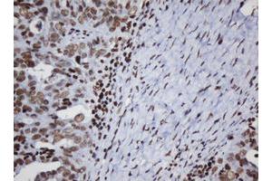 Image no. 1 for anti-Decapping Enzyme, Scavenger (DCPS) antibody (ABIN1497780) (DCPS anticorps)