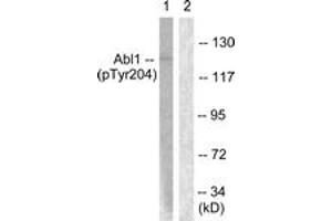 Western blot analysis of extracts from COS7 cells treated with Adriamycin 0. (ABL1 anticorps  (pTyr204))
